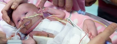 La bebé británica que nació con el corazón fuera de su cuerpo, ya ha sido dada de alta