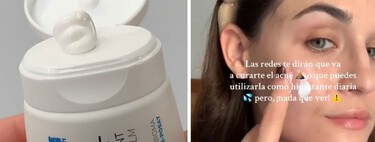 Unas farmacéuticas explican cómo usar correctamente el bálsamo Cicaplast: "Lo estás usando mal y nadie te lo está advirtiendo"