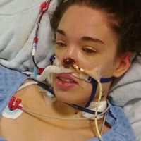 Una estudiante comparte las consecuencias de la meningitis W135 que casi acaba con su vida 