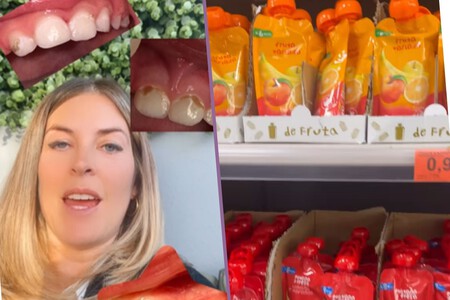 odontopediatra-caries