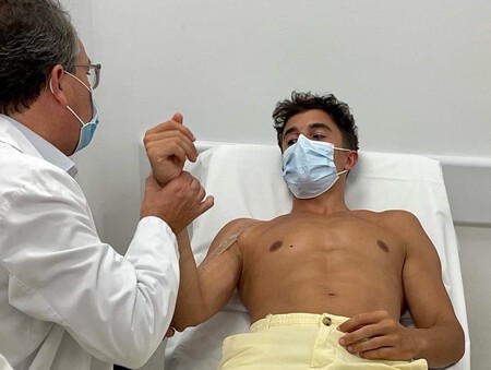Marc Marquez Brazo 2022