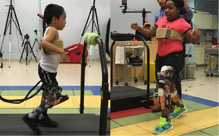 Esta prótesis permite andar a niños con parálisis cerebral
