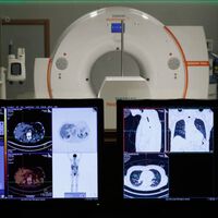 "Puede resumir 50 folios de estudios en cinco minutos": hablamos con los hospitales españoles que ya están utilizando la IA 