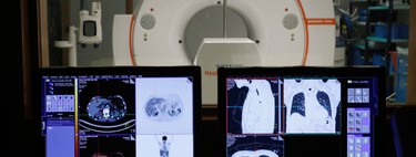 "Puede resumir 50 folios de estudios en cinco minutos": hablamos con los hospitales españoles que ya están utilizando la IA 