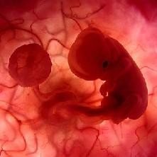 Estudio para determinar los mecanismos del aborto espontáneo