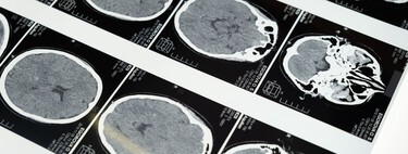 It's not just a matter of birthdays: poor metabolic health ages your brain in a completely independent way