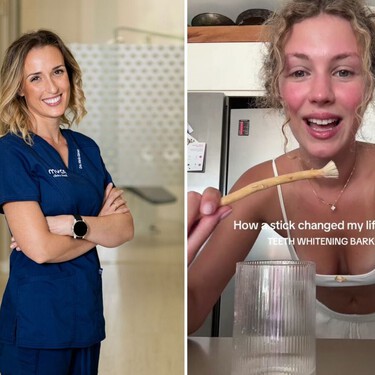 La odontóloga estética María Gámez, tajante con el uso del miswak para blanquear los dientes: “Tiene más riesgos que beneficios”