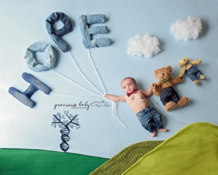 Cada bebé es precioso: las más bonitas fotos de bebés con necesidades médicas especiales