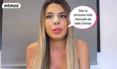 La Última Tentación: el estropicio que le hicieron a Andrea Gasca en la cara en una conocida clínica de Madrid