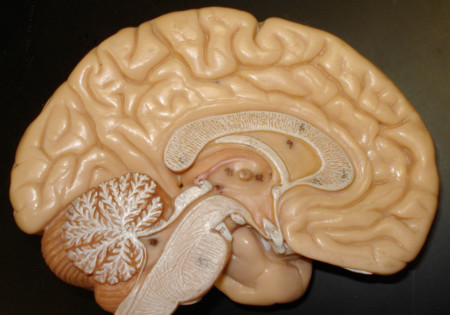 Correr mucho reduce el cerebro...¿En serio?