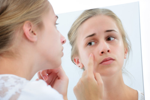 Acné en la adolescencia: por qué salen granos y qué cuidados hay que tener