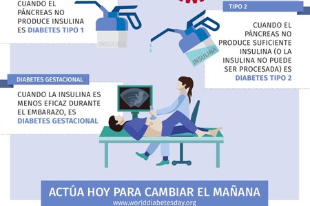 embarazo en diabetes tipo 1 embarazo en diabetes tipo 1