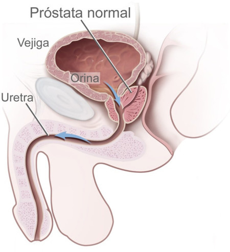 Prostata