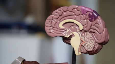 La obesidad podría afectar al riego sanguíneo cerebral y aumentar el riesgo de padecer Alzheimer
