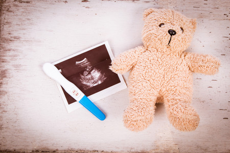 Istock 532169878 1
