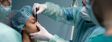 Brasil quiere combatir el bullying financiando operaciones estéticas a los niños y adolescentes que sufren acoso 