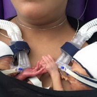 Los adorables mellizos prematuros que se cogen de la mano cuando están juntos