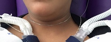 Los adorables mellizos prematuros que se cogen de la mano cuando están juntos