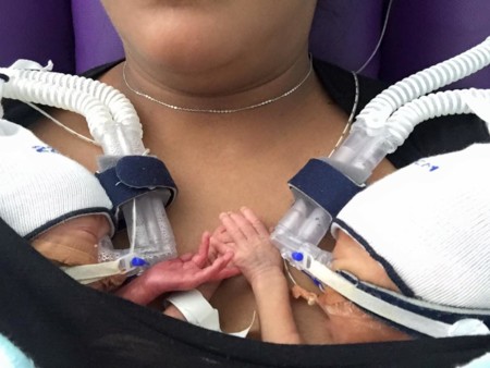 Los adorables mellizos prematuros que se cogen de la mano cuando están juntos
