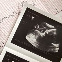 La ecografía transvaginal: qué es, cómo y cuándo se realiza