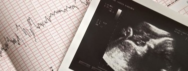 La ecografía transvaginal: qué es y cuándo se realiza