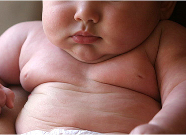 La obesidad infantil podría estar causada por un gen