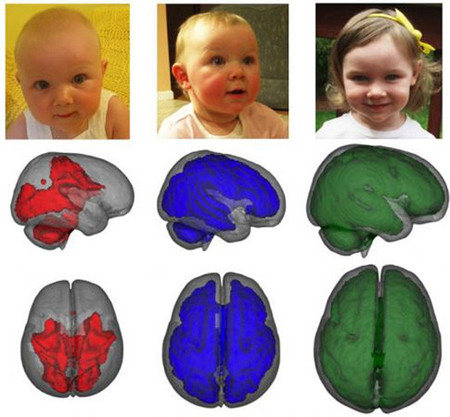 Los niños que toman leche artificial tienen un peor desarrollo cerebral que los que toman leche materna