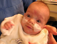 Un bebé prematuro de 300 gramos ha sobrevivido sin complicaciones