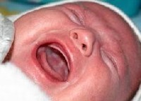 El consumo de drogas durante el embarazo causa problemas neurológicos en el bebé