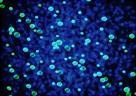 El envejecimiento del cerebro podría revertirse gracias al potencial de los microbios