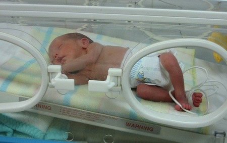 Un programa informático predice las enfermedades de los prematuros