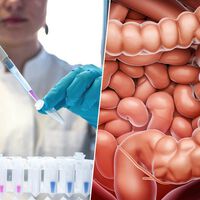 Los cánceres de colon están aumentando de forma alarmante entre los jóvenes. Tenemos un sospechoso: el sedentarismo