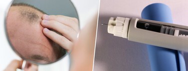 Cuando nos dijeron los beneficios de medicamentos como Ozempic se dejaron un detalle: pueden dejarnos calvos