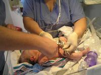 Esperar tres minutos para cortar el cordón umbilical, beneficioso para la salud del bebé