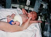 La edad de los prematuros debe corregirse durante los dos primeros años