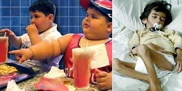 Los dos extremos, desnutrición y obesidad infantil