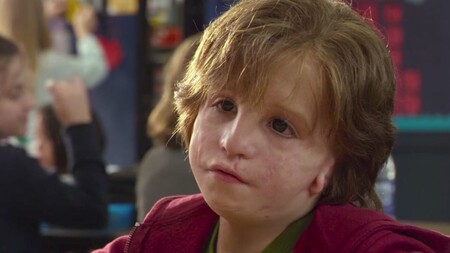 Síndrome de Treacher Collins: todo sobre la enfermedad que hizo visible la película 'Wonder'