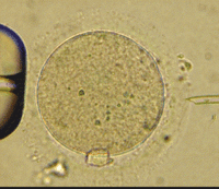 Todo sobre fecundación in vitro en la revista "Mi ginecólogo"