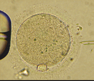 Todo sobre fecundación in vitro en la revista "Mi ginecólogo"