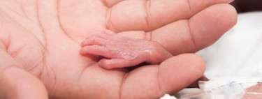 La historia de "Emilín el guerrero", un gran prematuro de 23 semanas de gestación que ha salido adelante sin secuelas