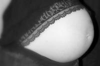 Desmitificando la cesárea por rutina después de una cesárea