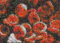 Las hemoglobinopatías, unas peligrosas enfermedades hereditarias 