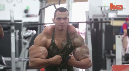Quería los brazos de Hulk... y casi se los tienen que amputar