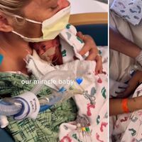El emotivo momento en que una madre de gemelos prematuros nacidos con 23 semanas los abraza por primera vez 