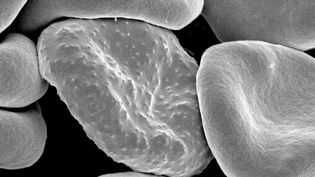 El mayor crimen de la humanidad: la malaria