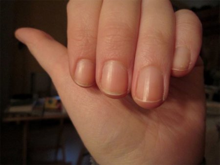 Consejos para evitar las uñas quebradizas