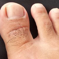 Você sabia? Os pelos que crescem nos dedos dos pés podem ser um sinal de boa circulação sanguínea 