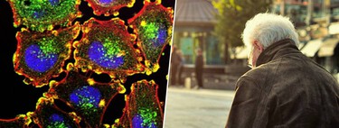 Hemos encontrado el "interruptor" del envejecimiento celular. El secreto se llama proteína AP2A1