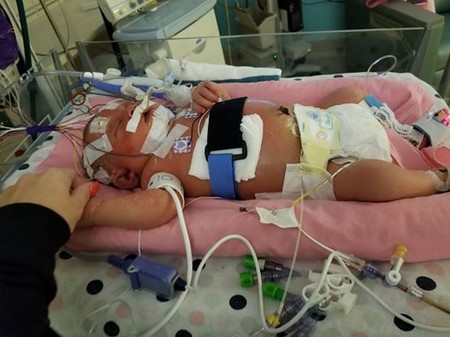 Que nadie bese a tu recién nacido: una bebé de 18 días muere al contraer meningitis por culpa de un beso