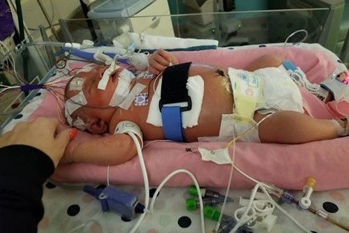 Que nadie bese a tu recién nacido: una bebé de 18 días muere al contraer meningitis por culpa de un beso